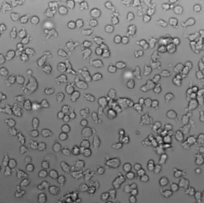人急性淋巴母细胞性白血病细胞