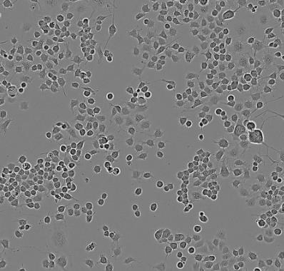 MRMT-1 大鼠乳腺癌细胞系的应用