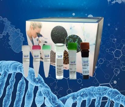 南非诺卡菌PCR试剂盒的应用