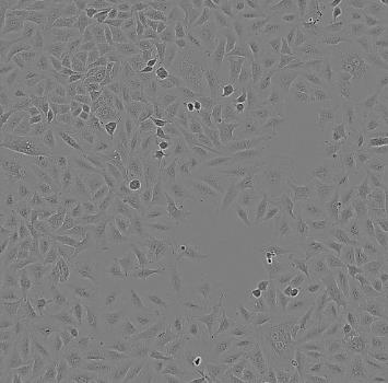 CAL-62人甲状腺癌贴壁细胞系