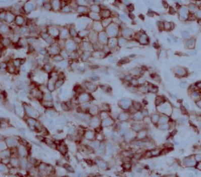 NB2 大鼠淋巴瘤细胞系.png