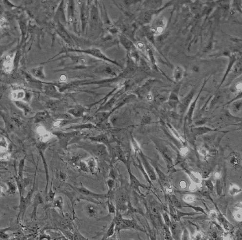 CFSC-2G鼠肝星形贴壁细胞系的应用