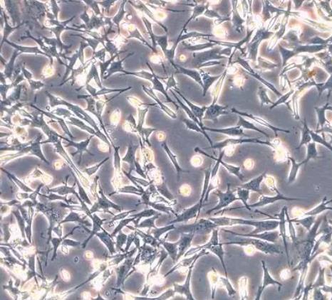 MOLP-8细胞系|人多发性骨髓瘤细胞的应用