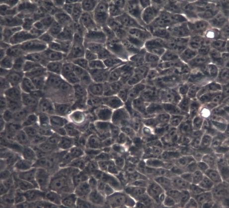 RIN-14B 大鼠胰岛素瘤细胞系.png