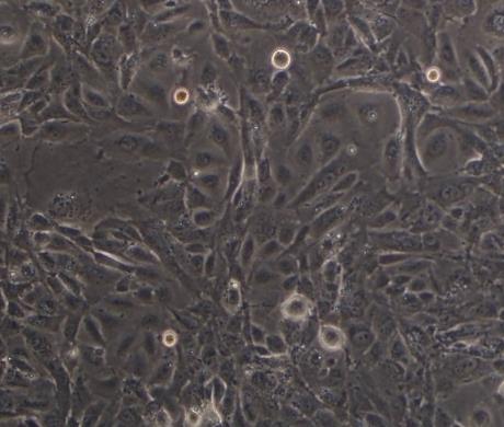 FU-MMT-1 人子宫肉瘤细胞系的应用