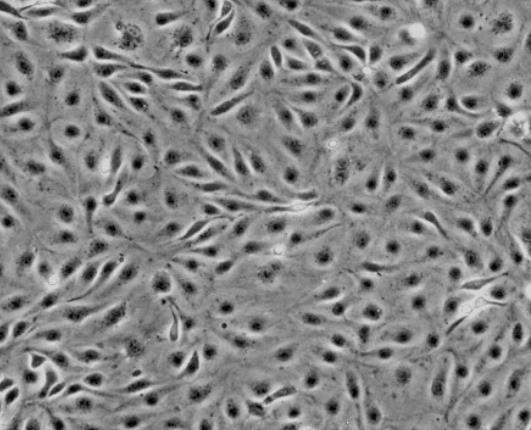 HULEC-5A 人肺微血管内皮细胞系的应用
