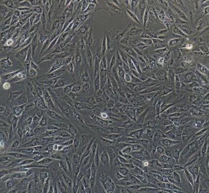 Rat Tracheal Smooth Muscle Cells.png