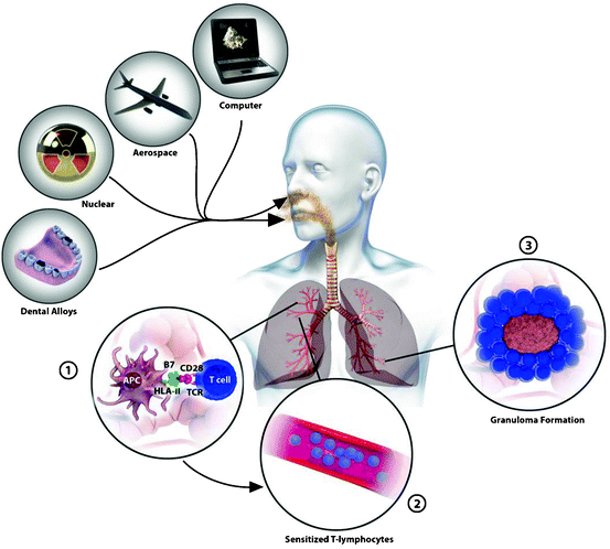 7440-38-2 arsenicUses of high-purity arsenicAcute Toxicity of arsenic
