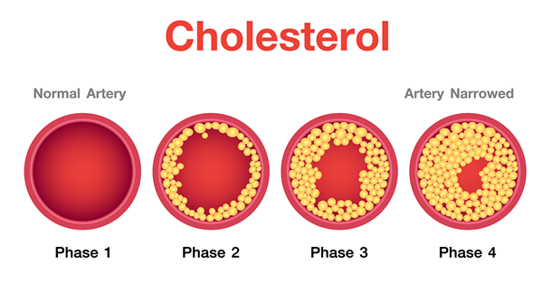 57-88-5 CholesterolLevelsPreventDaily life