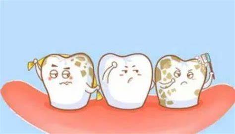 Fig1.Dental fluorosis