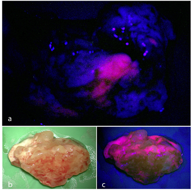 5451-09-2 5-Aminolevulinic acid hydrochlorideALAphotodynamic therapyFluorescence-guided neurosurgery