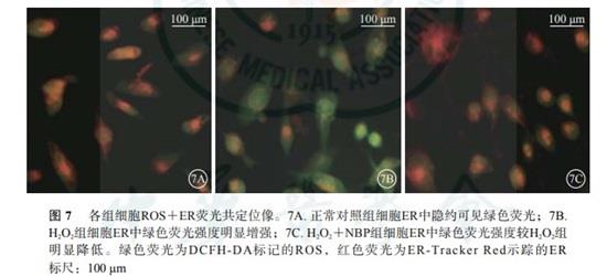 2',7'-二氯荧光素二乙酸酯的应用-5.jpg