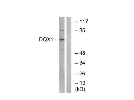 DQX1抗体的使用方法