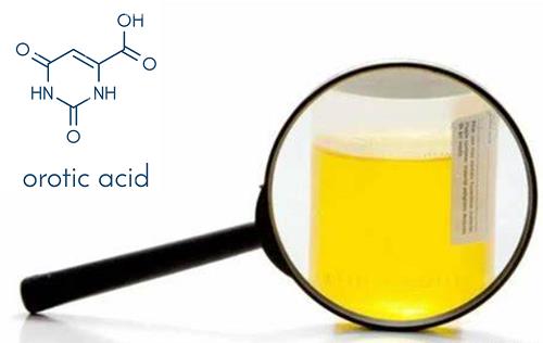 orotic acid in urina.png