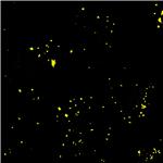 AIE Yellow Probe for Lipid droplets pictures