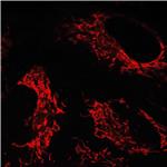 AIE NIR Probe for Mitochondrion pictures