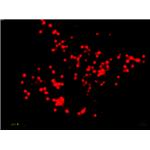 AIE Super-Resolution RED - Lipid Droplets pictures