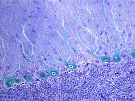 脑源性酸性成纤维细胞生长因子