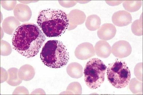 人外周血白血病T细胞 ；Jurkat细胞