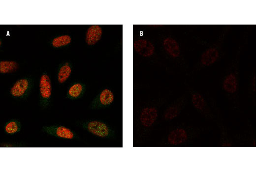 磷酸化组蛋白 H2A.X (139位) 兔单克隆抗体