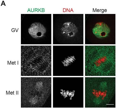 AURORA B RABBIT MONOCLONAL ANTIBODY