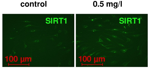 SIRT1 兔多克隆抗体