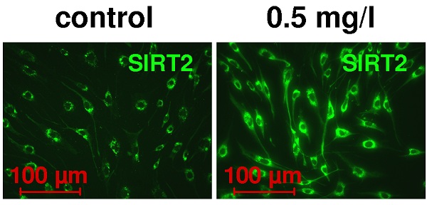 SIRT2 兔单克隆抗体