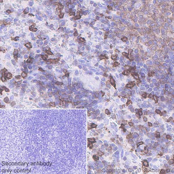 LSP1 兔单克隆抗体