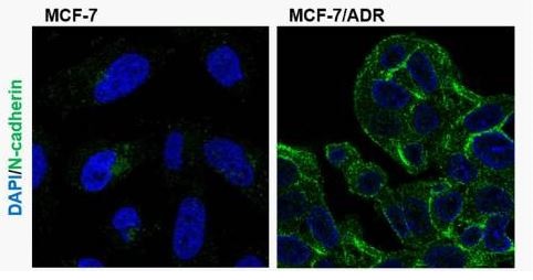 N-CADHERIN 兔多克隆抗体