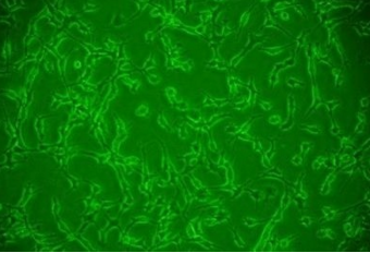 HBZY－1/大鼠肾小球系膜细胞EC(HBZY-1)