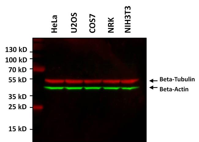 beta Actin Monoclonal Antibody (15G5A11/E2)