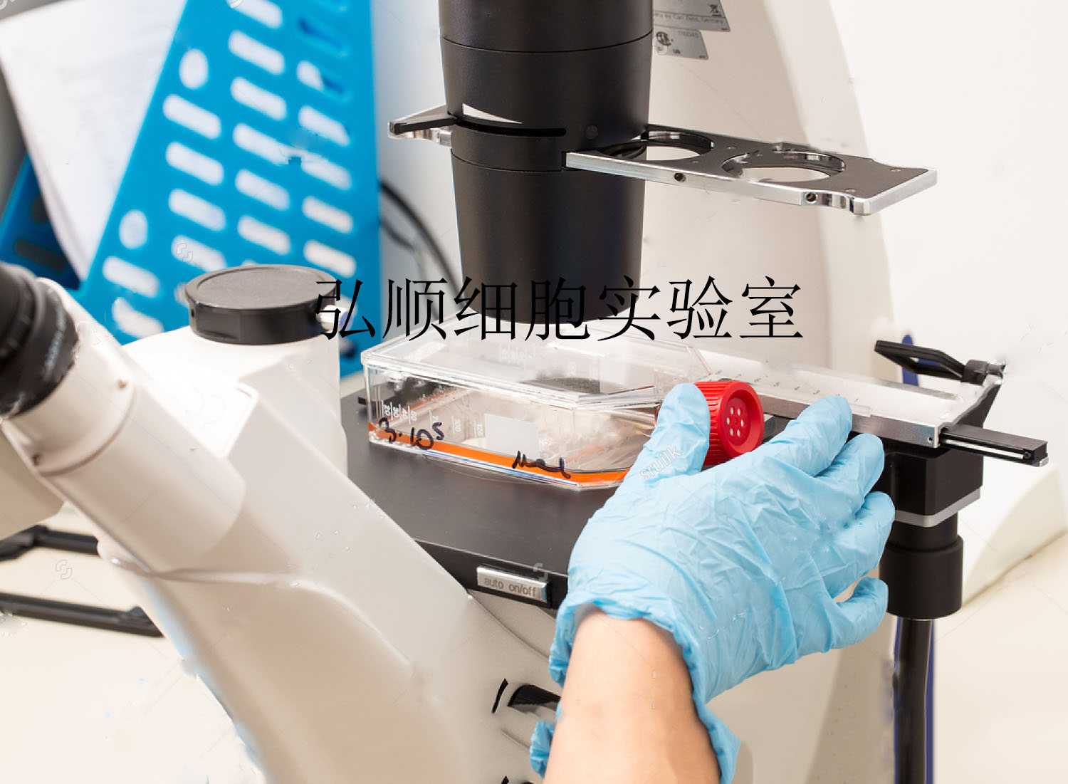 RIN-m细胞：褐鼠胰岛素瘤上皮细胞