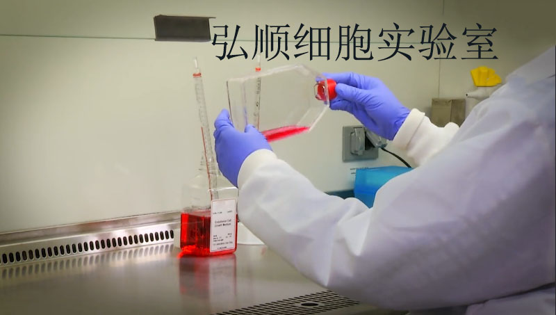 NCI-H295R[H295R]细胞：人肾上腺皮质腺癌细胞