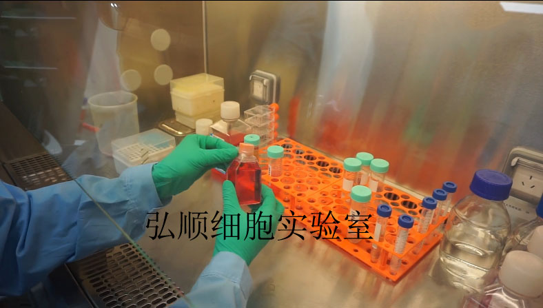 NCM356细胞：结直肠腺癌细胞