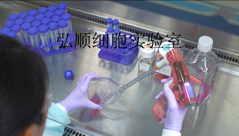 TMD8细胞：人弥漫大B淋巴瘤细胞