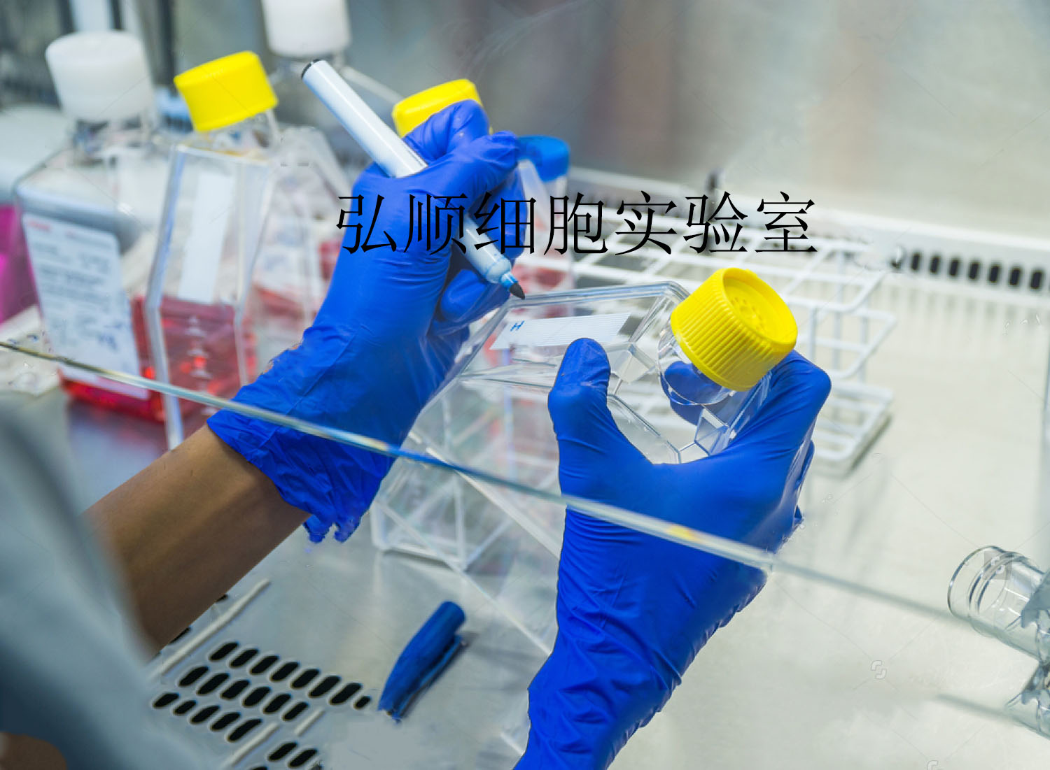 KLN205细胞系|小鼠肺鳞癌细胞系