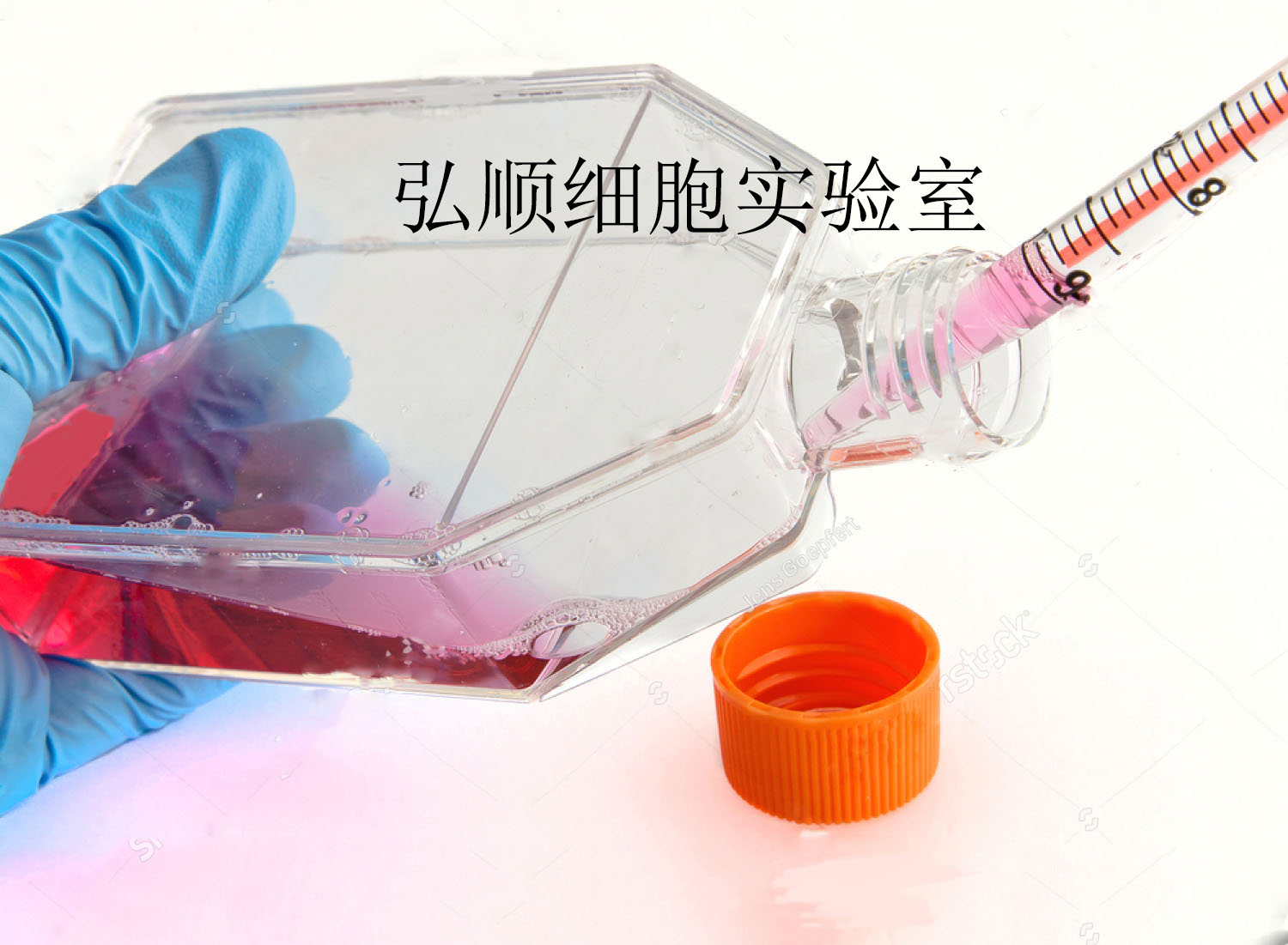 HCCC-9810 Cell<人胆管细胞型肝癌细胞系>