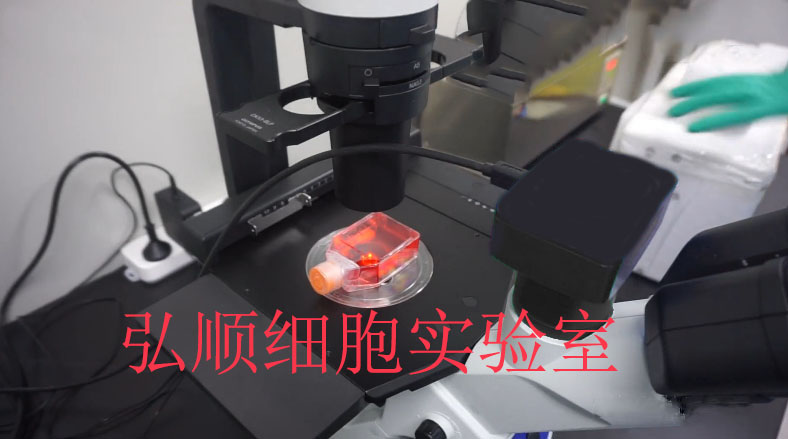 NCI-H2172 Cell<人非小细胞肺癌细胞系>