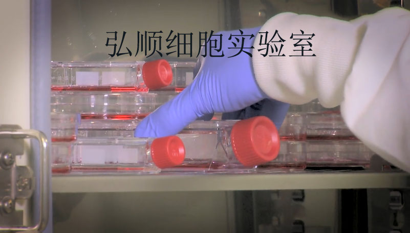HepG2215 Cell<人肝癌细胞系>