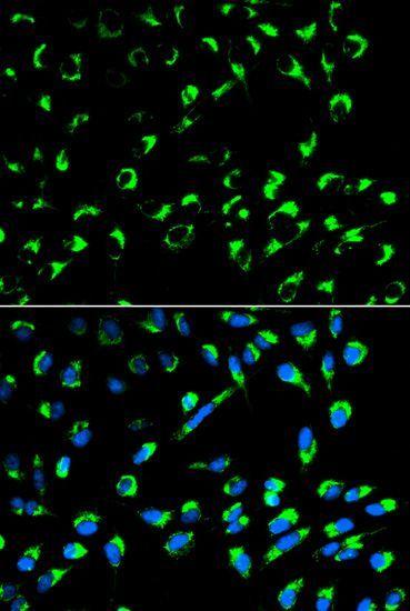 14-3-3 sigma antibody