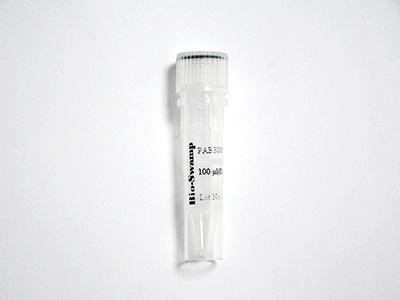 AR Polyclonal Antibody