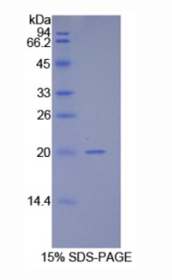 10kDa热休克蛋白1(HSP10)重组蛋白