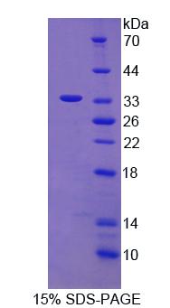110kDa中心体蛋白(CEP110)重组蛋白