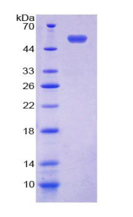 153kDa核孔蛋白(NUP153)重组蛋白