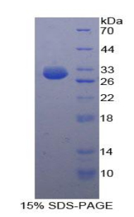 160kDa核孔蛋白(NUP160)重组蛋白