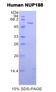 188kDa核孔蛋白(NUP188)重组蛋白
