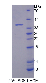 214kDa核孔蛋白(NUP214)重组蛋白
