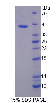 3-羟基丁酸脱氢酶1(BDH1)重组蛋白