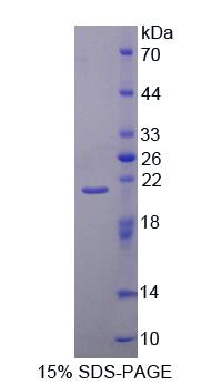 40kDa热休克蛋白2(HSPF2)重组蛋白