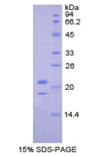 43kDa Tar DNA结合蛋白(TDP43)重组蛋白